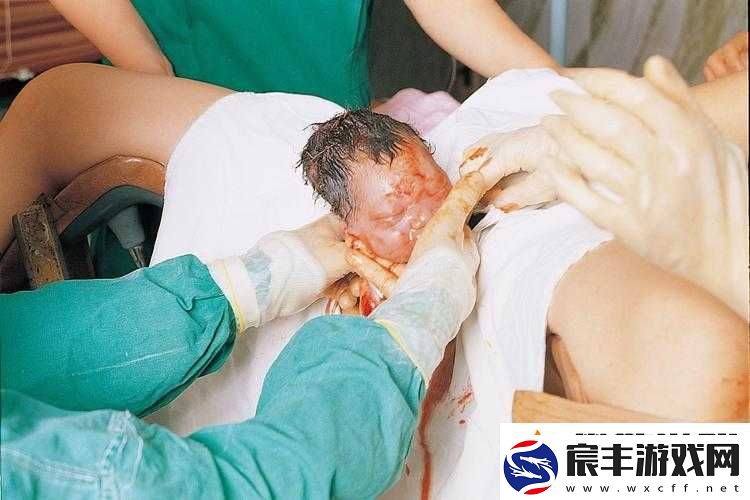 胎头湿漉漉挤出：分娩艰难瞬间