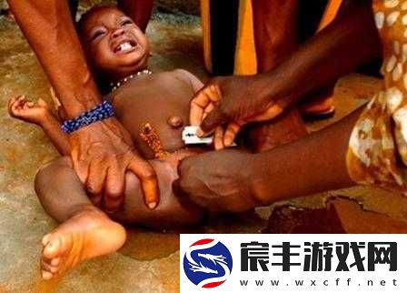 老女人大荫蒂毛茸茸怎么办：是否需要修剪？